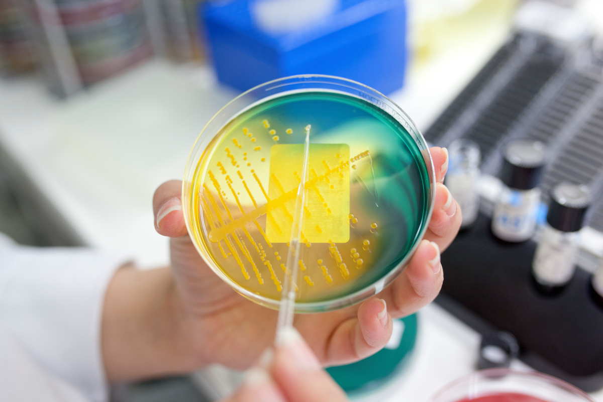 En hånd holder en petriskål med fargerik agar, gul og grønn. Gul bakteriekultur vises tydelig, med laboratorieutstyr i bakgrunnen.