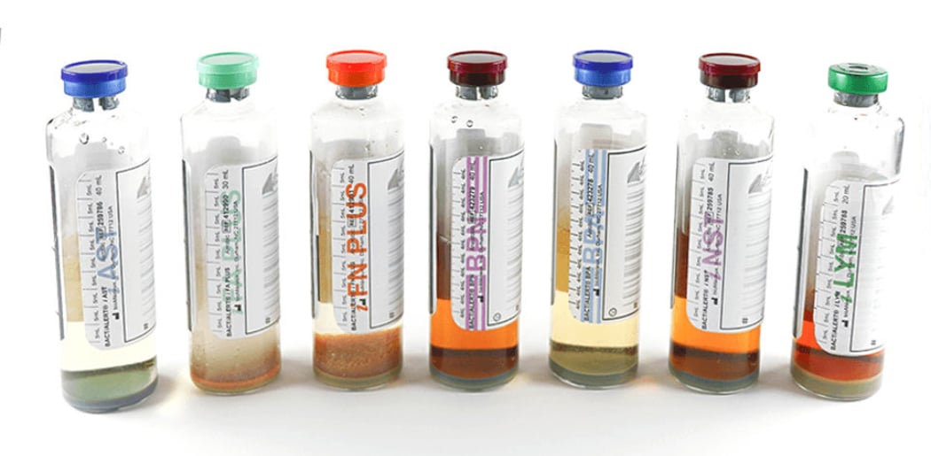 Seven test tubes with different colors on the lids, contain different liquids, arranged in a row.