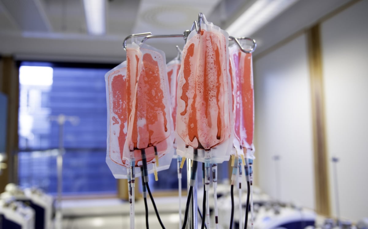 Flere poser med rødt væske henger i et stativ, omgitt av ledninger, i et moderne rom med store vinduer og lys innredning.