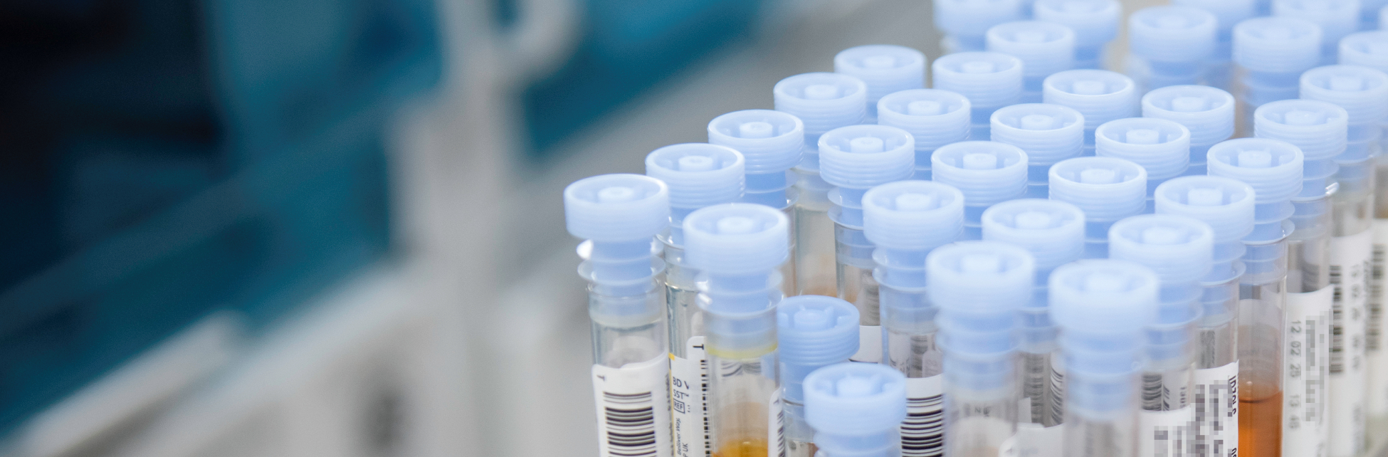 Stativ med mange reagensrør klare for analyse.